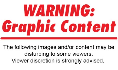 graphic content